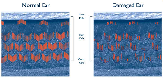 How you hear diagram